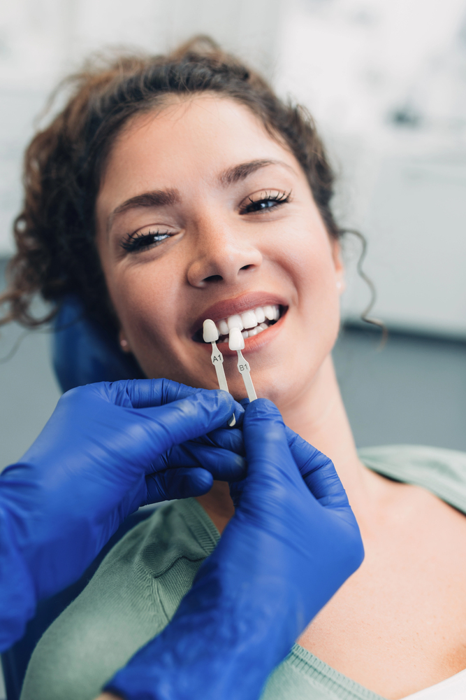 Emax Veneers